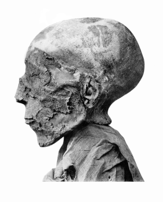 Seti_II_mummy_head