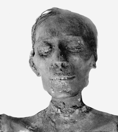Thoetmosis_IV_mummy_head